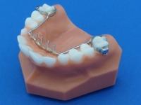 Best Dental Hospitals in Guntur,Best Dental Hospital in Guntur,Best Dental Doctor in Guntur,Best Dental Doctors in Guntur,Best Dental Clinic in Guntur,Best Dental Clinics in Guntur,Famous Dental Hospitla in guntur,Famous dental hospitals in guntur,Best Dental clinic near me,Best Evening Hospitals in Guntur,Best Orthodontist in guntur,Braces Treatment in Guntur,Best Dentist in Guntur,Best Dentists in Guntur,Best Habit breaking appliance treatment in Guntur,Hygienic dental Hospital in Guntur,Hygienic dental Hospitals in Guntur,Top Dentist in guntur,Top Dentistits in guntur,Top Dental Clinics in Guntur,Top Oarl Dental Clinics in Guntur,Top Dental Clinic in Guntur,Best Dental Implants in guntur,Top Dental Doctors in guntur,Top Dental Doctors in Guntur,Oral treatments and dental health services in Guntur,Oral treatments and dental health services in Guntur,Dental Braces in Guntur,Complete Dental Oral care in guntur,Best dental treatment in guntur,Best Fever Hospital in Guntur,Best Hypertensive Clinics in Guntur,Best thyroid doctors in guntur,Best Cardiologist in guntur,Best Evening clinics in Guntur