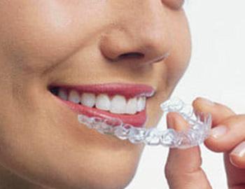 Best Dental Hospitals in Guntur,Best Dental Hospital in Guntur,Best Dental Doctor in Guntur,Best Dental Doctors in Guntur,Best Dental Clinic in Guntur,Best Dental Clinics in Guntur,Famous Dental Hospitla in guntur,Famous dental hospitals in guntur,Best Dental clinic near me,Best Evening Hospitals in Guntur,Best Orthodontist in guntur,Braces Treatment in Guntur,Best Dentist in Guntur,Best Dentists in Guntur,Best Habit breaking appliance treatment in Guntur,Hygienic dental Hospital in Guntur,Hygienic dental Hospitals in Guntur,Top Dentist in guntur,Top Dentistits in guntur,Top Dental Clinics in Guntur,Top Oarl Dental Clinics in Guntur,Top Dental Clinic in Guntur,Best Dental Implants in guntur,Top Dental Doctors in guntur,Top Dental Doctors in Guntur,Oral treatments and dental health services in Guntur,Oral treatments and dental health services in Guntur,Dental Braces in Guntur,Complete Dental Oral care in guntur,Best dental treatment in guntur,Best Fever Hospital in Guntur,Best Hypertensive Clinics in Guntur,Best thyroid doctors in guntur,Best Cardiologist in guntur,Best Evening clinics in Guntur