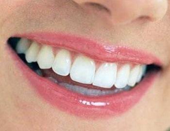 Best Dental Hospitals in Guntur,Best Dental Hospital in Guntur,Best Dental Doctor in Guntur,Best Dental Doctors in Guntur,Best Dental Clinic in Guntur,Best Dental Clinics in Guntur,Famous Dental Hospitla in guntur,Famous dental hospitals in guntur,Best Dental clinic near me,Best Evening Hospitals in Guntur,Best Orthodontist in guntur,Braces Treatment in Guntur,Best Dentist in Guntur,Best Dentists in Guntur,Best Habit breaking appliance treatment in Guntur,Hygienic dental Hospital in Guntur,Hygienic dental Hospitals in Guntur,Top Dentist in guntur,Top Dentistits in guntur,Top Dental Clinics in Guntur,Top Oarl Dental Clinics in Guntur,Top Dental Clinic in Guntur,Best Dental Implants in guntur,Top Dental Doctors in guntur,Top Dental Doctors in Guntur,Oral treatments and dental health services in Guntur,Oral treatments and dental health services in Guntur,Dental Braces in Guntur,Complete Dental Oral care in guntur,Best dental treatment in guntur,Best Fever Hospital in Guntur,Best Hypertensive Clinics in Guntur,Best thyroid doctors in guntur,Best Cardiologist in guntur,Best Evening clinics in Guntur